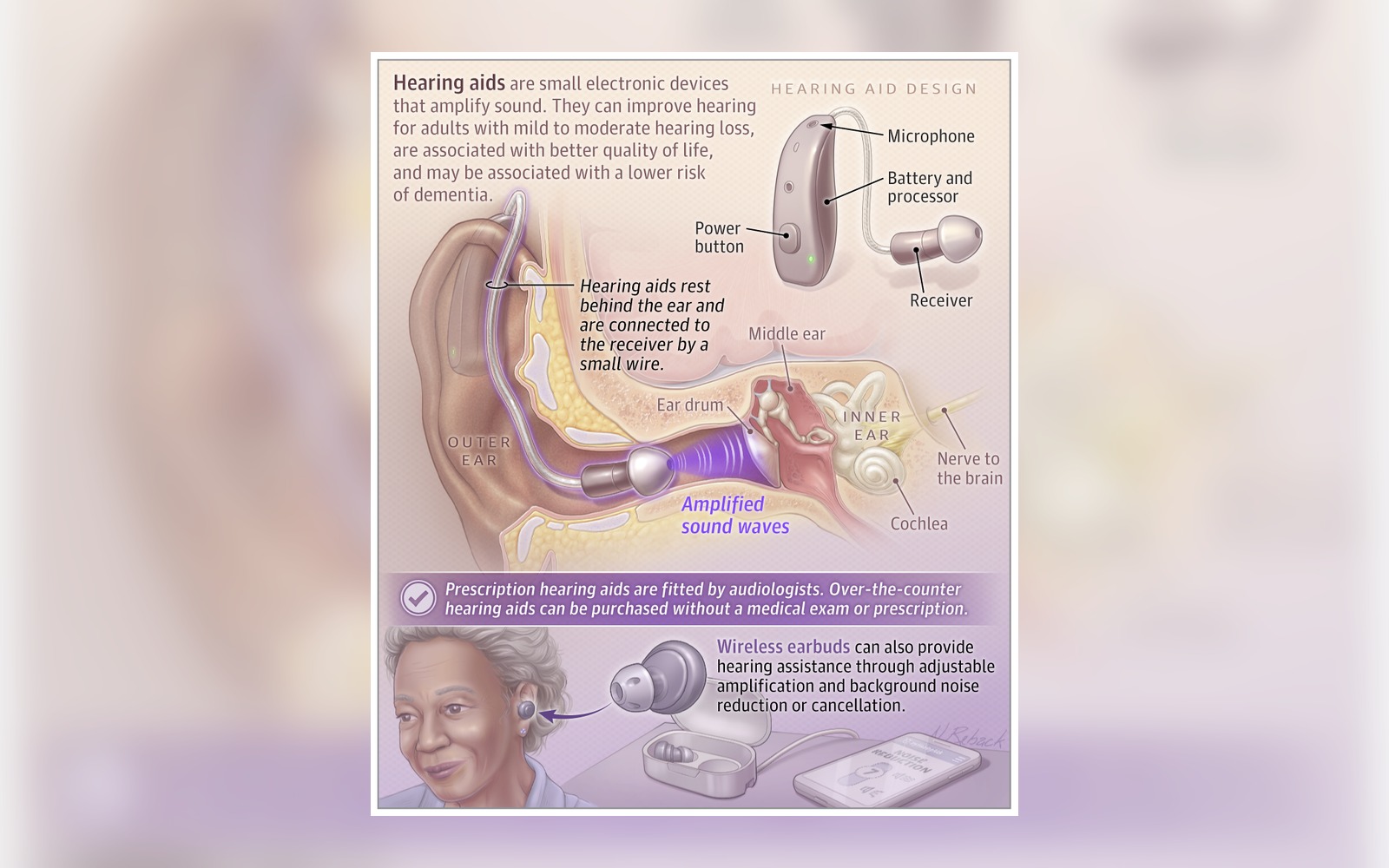 JAMA Patient Page visual for adults with mild to moderate hearing loss